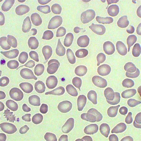 tear drops blood test|blood tear cells dc.